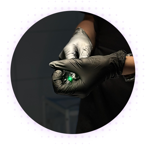 Прижигание миндалин лазером (лазерная лакунотомия)