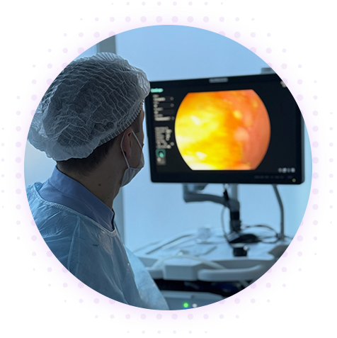 Полипы матки, цервикального канала