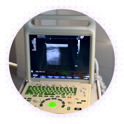 УЗДС (вен и артерий)