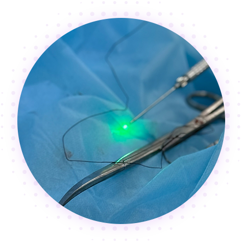 ЭВЛК (эндовазальная лазерная коагуляция)