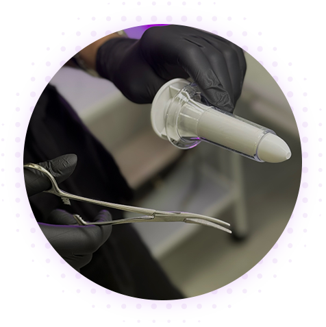 Парапроктит